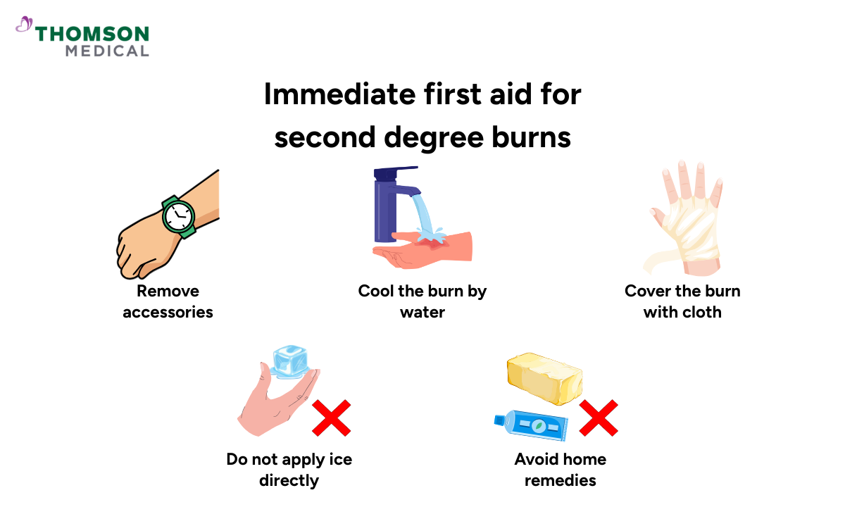 blog-image_ucc_first-aid-for-second-degree-burns.png