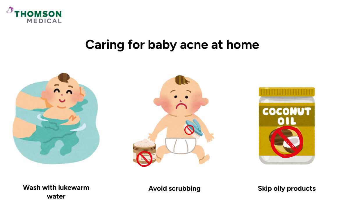 Illustration of caring for baby acne at home