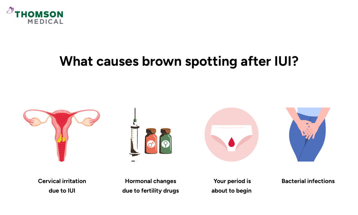 blog-image_obgyn_brown-spotting-causes.png
