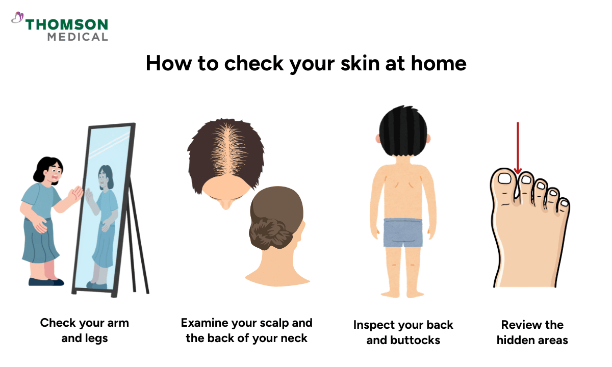 How to check your skin at home