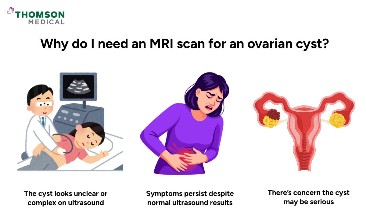 Illustration of why I need an MRI scan for an ovarian cyst