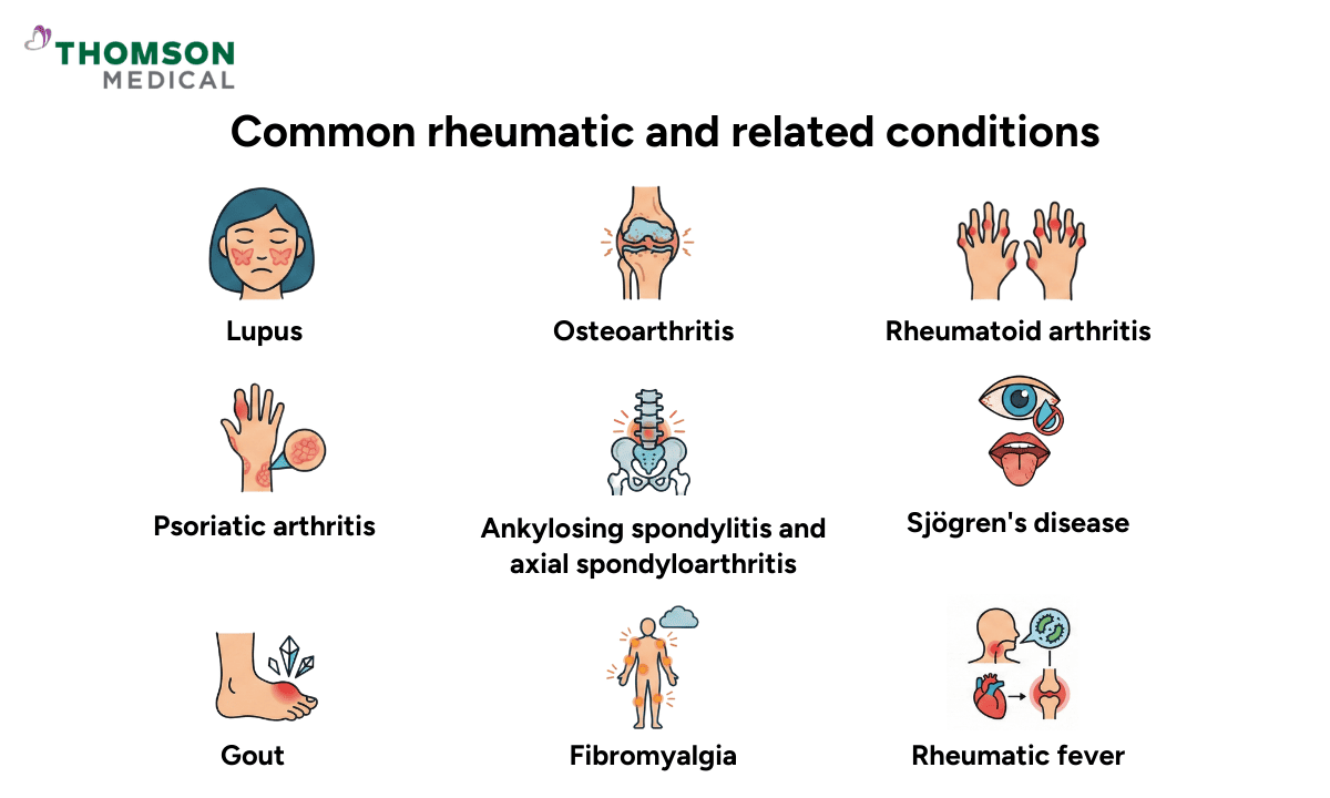 An infographic titled Common rheumatic and related conditions featuring icons for Lupus, Osteoarthritis, Rheumatoid arthritis, Psoriatic arthritis, Ankylosing spondylitis, Sjögren's disease, Gout, Fibromyalgia, and Rheumatic fever.