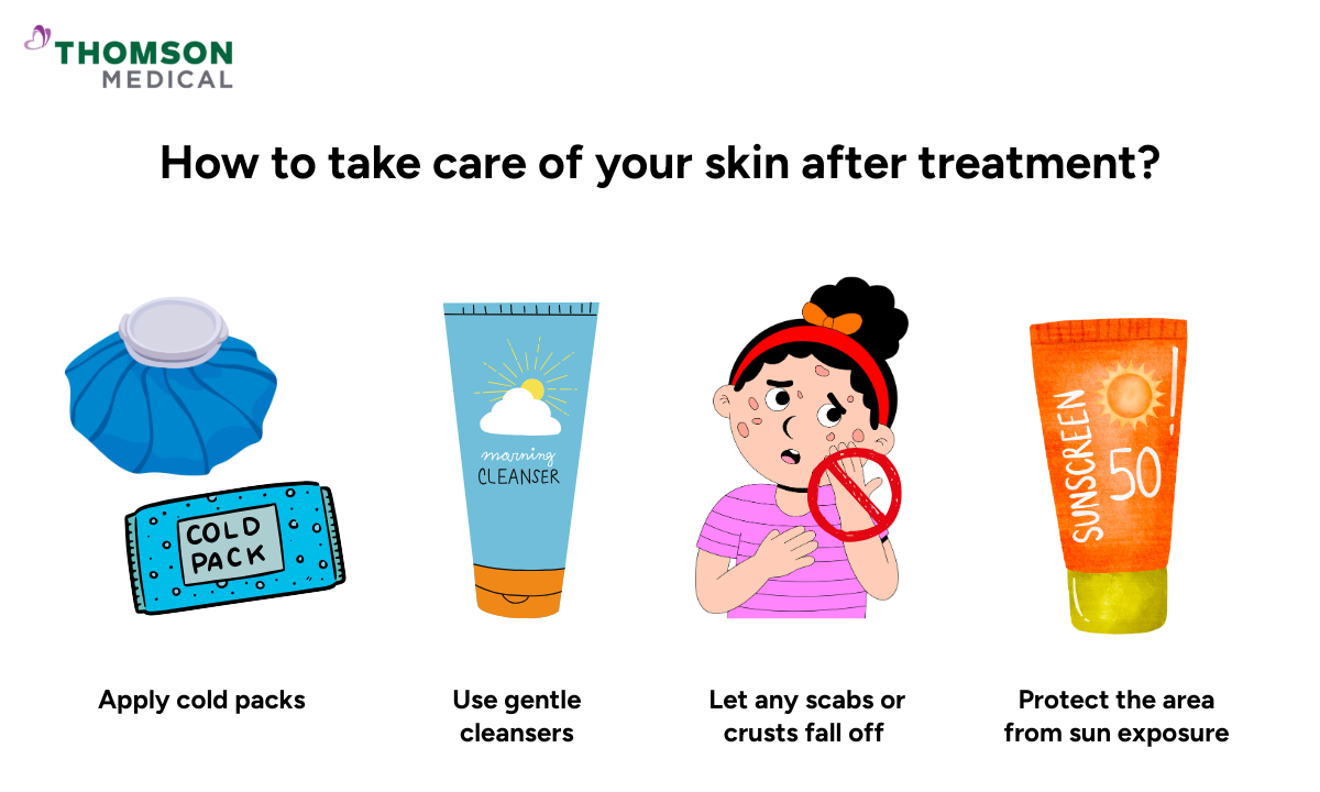 How to take care of your skin after treatment?
