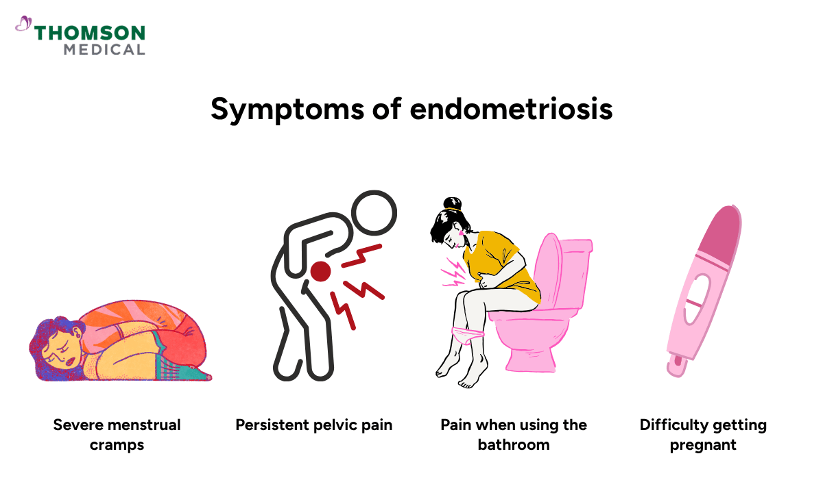 illustration of endometriosis symptoms