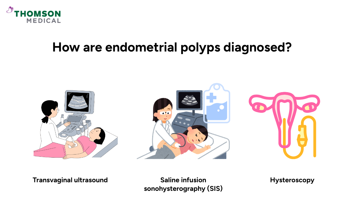 Infographic showing methods of endometrial polyps diagnosis
