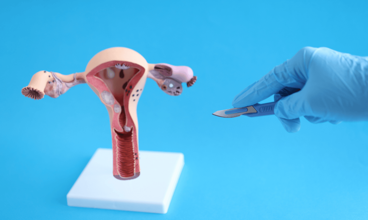 image of gynaeoclogical surgery