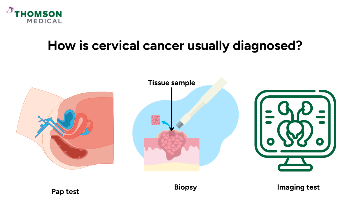 how cervical cancer is usually diagnosed
