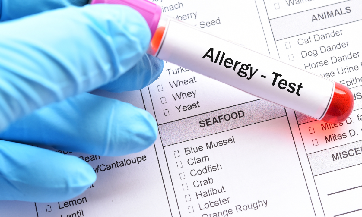 A hand in a blue medical glove holding a blood sample tube labeled 'Allergy - Test' over a paperwork checklist of common allergens like seafood and animals.