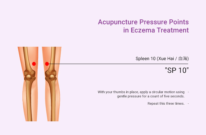 acupuncture-pressure-points-in-eczema-treatment-spleen-10-Xue-Hai.jpeg