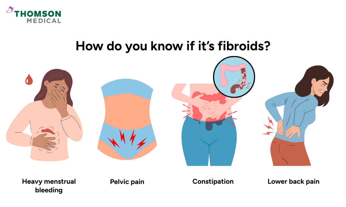 Illustration on how do you know if it’s fibroids