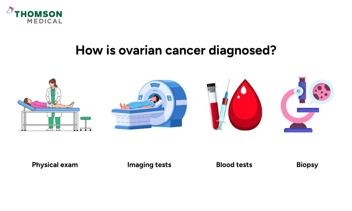 4-tests-to-diagnose-ovarian-cancer