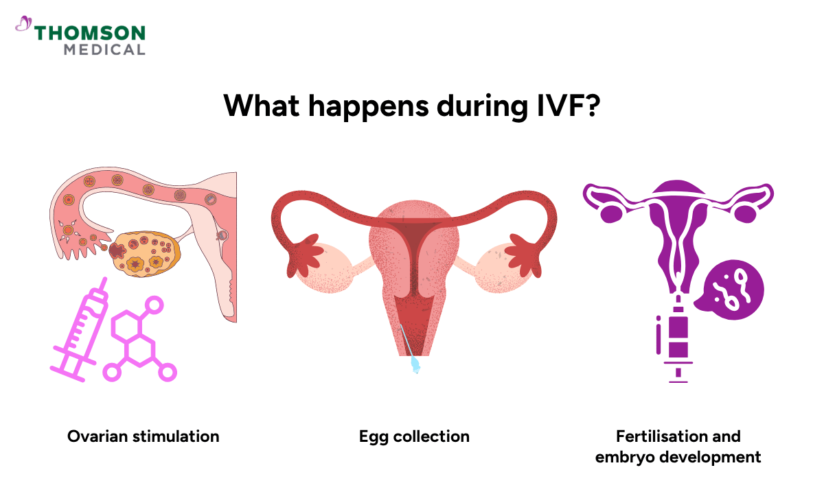 illustration of what happens during IVF