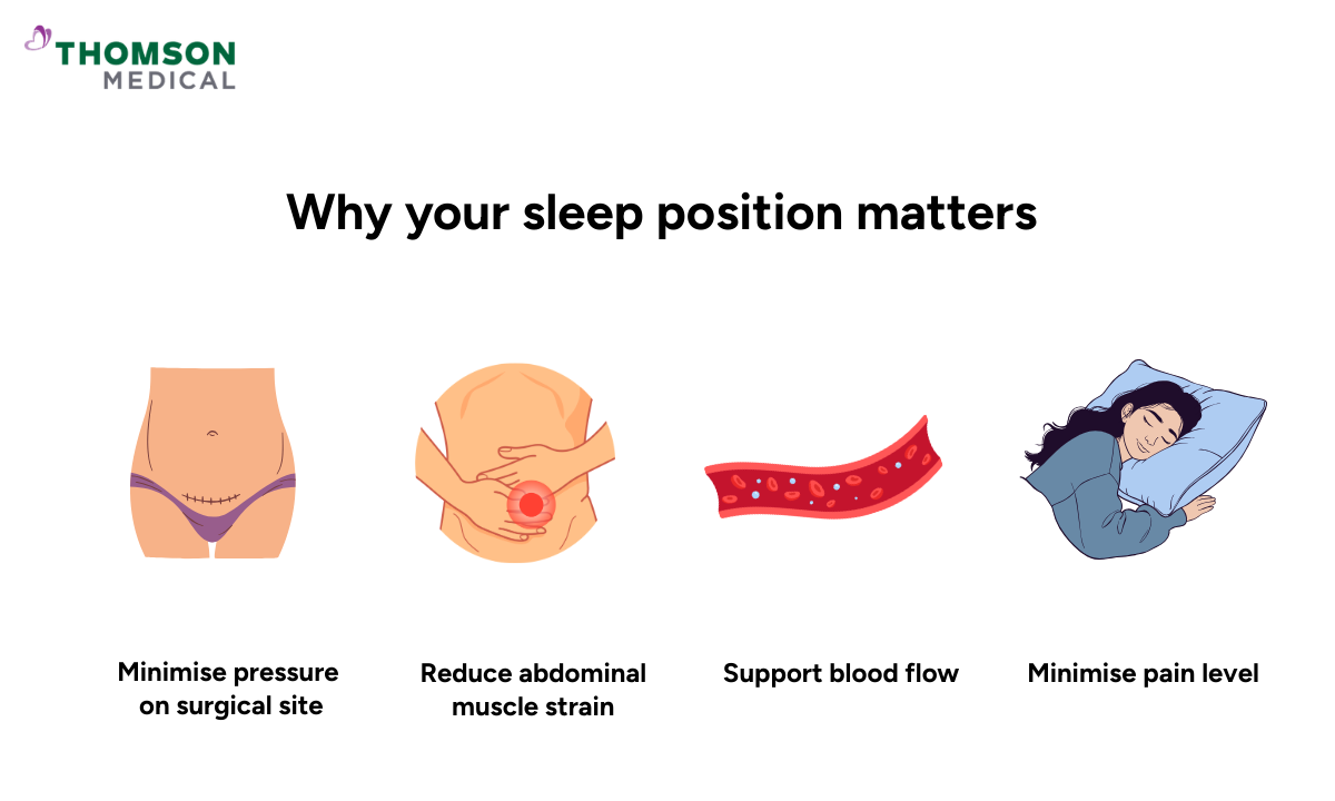 Infographic showing reasons why sleep position matters after a myomectomy