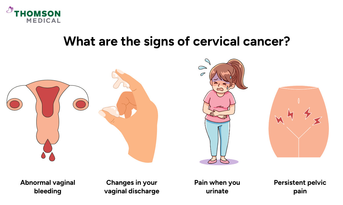 Illustration of signs of cervical cancer