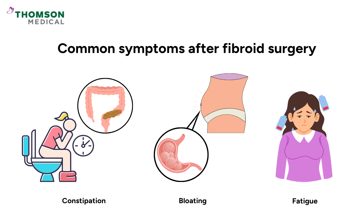 illustration common symptoms after fibroid surgery