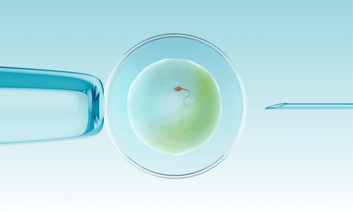 Illustration of ICSI