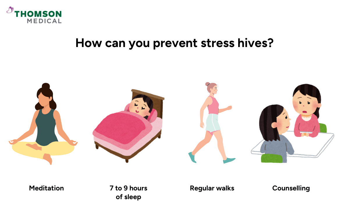 How to prevent stress hives