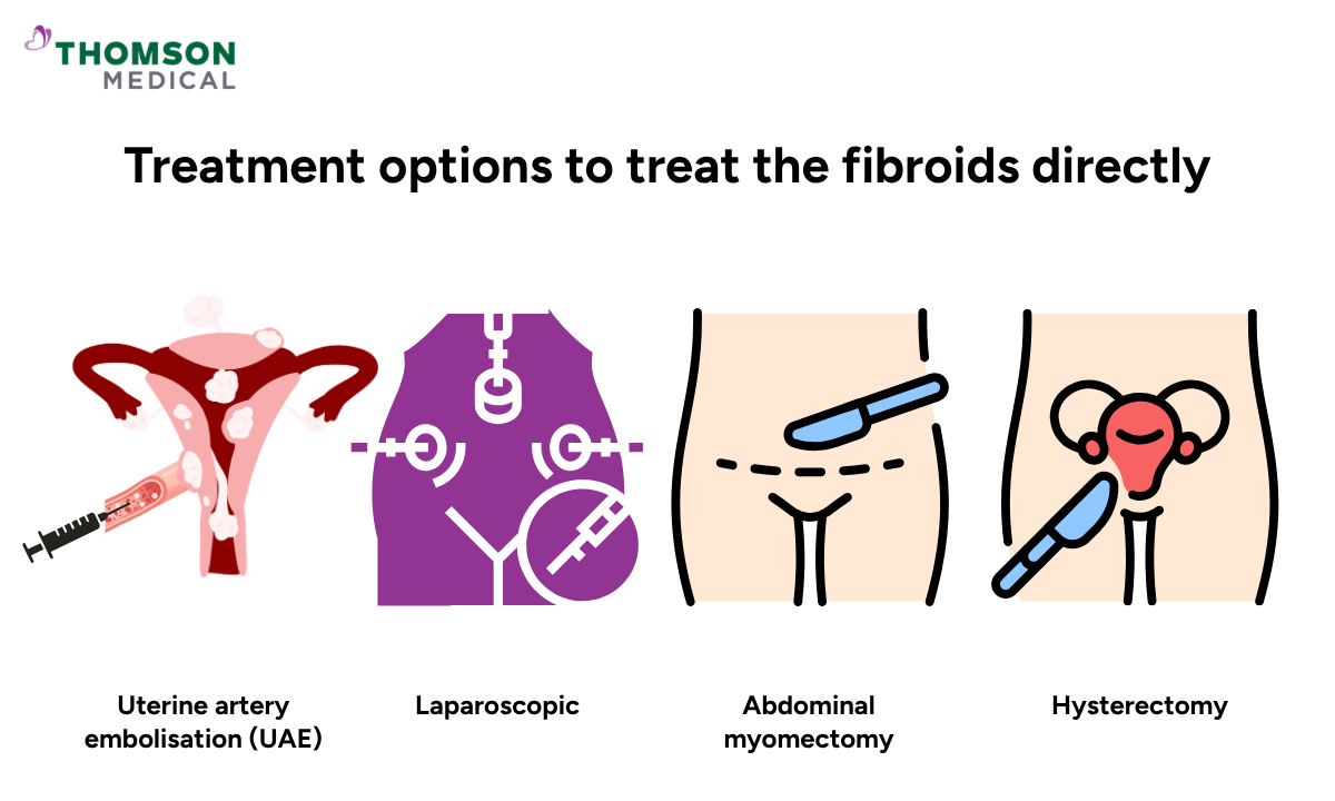 Illustration shows the treatment options to treat the fibroids directly