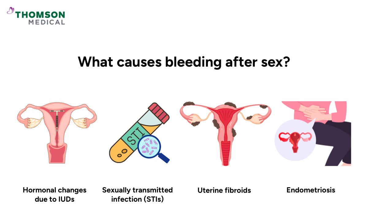 illustration of what causes bleeding after sex
