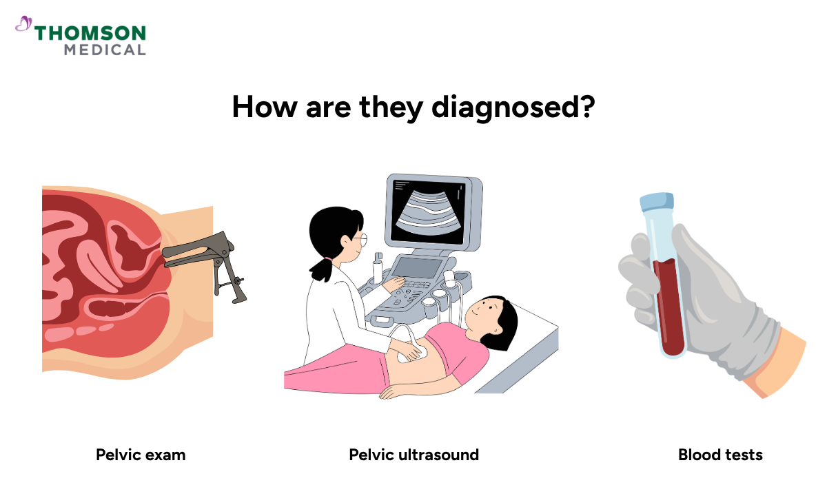 how adenomyosis and fibroids are diagnosed
