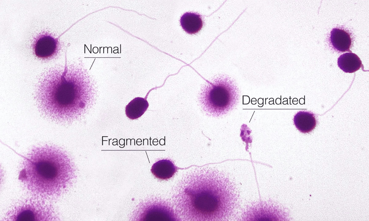 blog-image_obgyn_sperm-dna-fragmentation.png