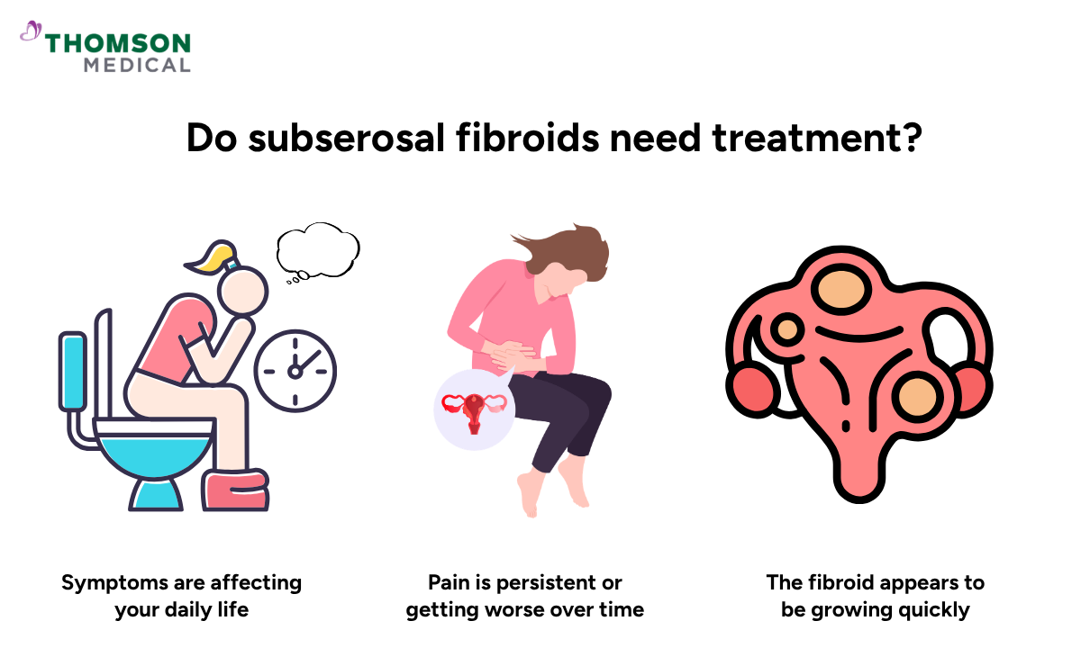 Illustration shows when do subserosal fibroids need treatment