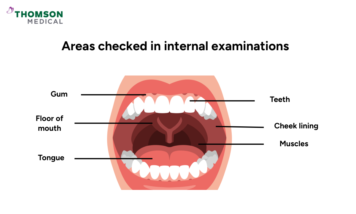 What does internal dental examination check