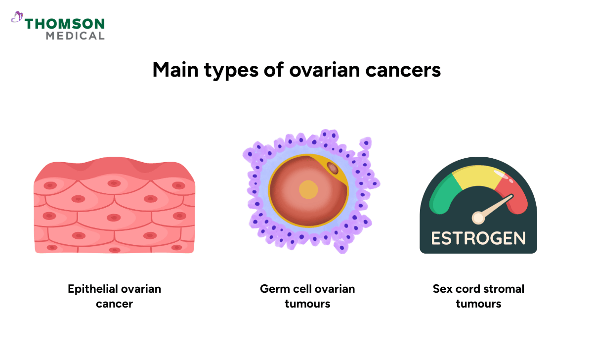 illustration of ovarian cancer types