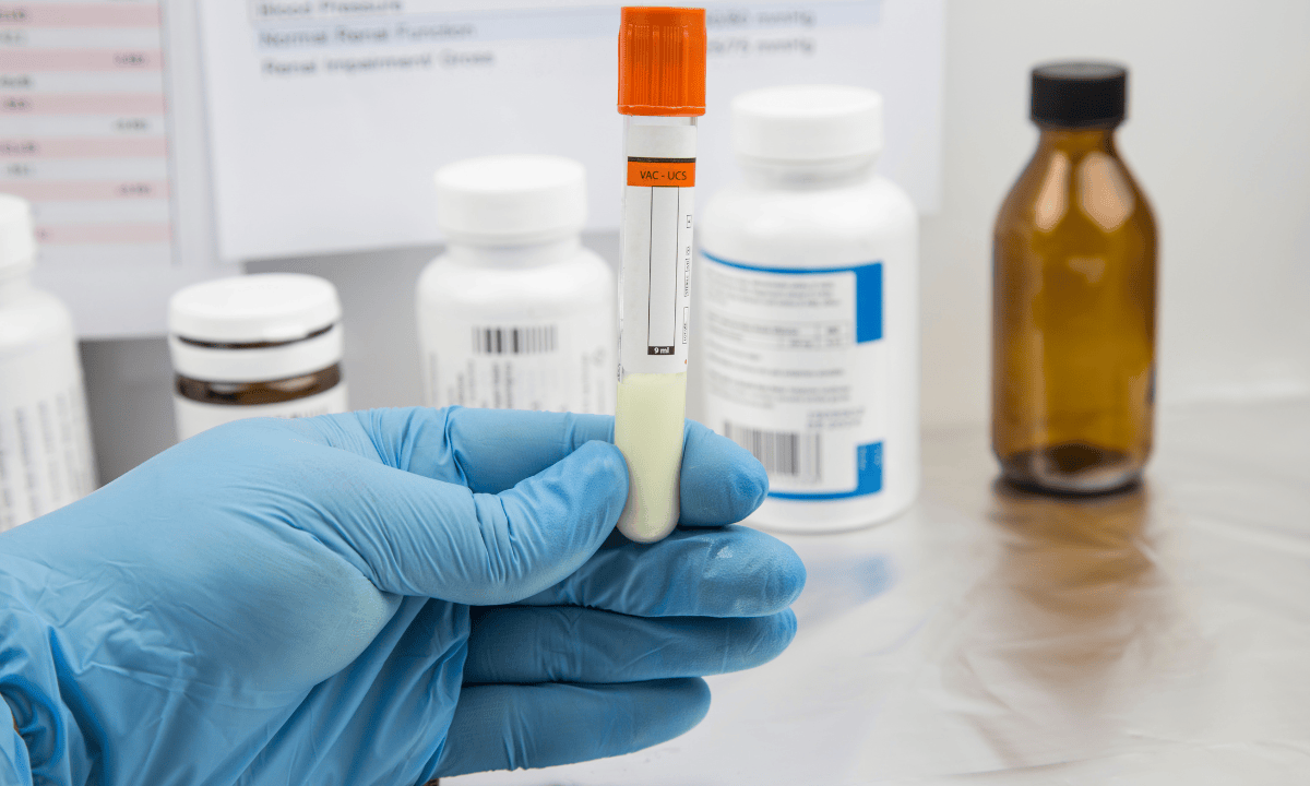 blog-image_screening_sperm-test-in-lab.png