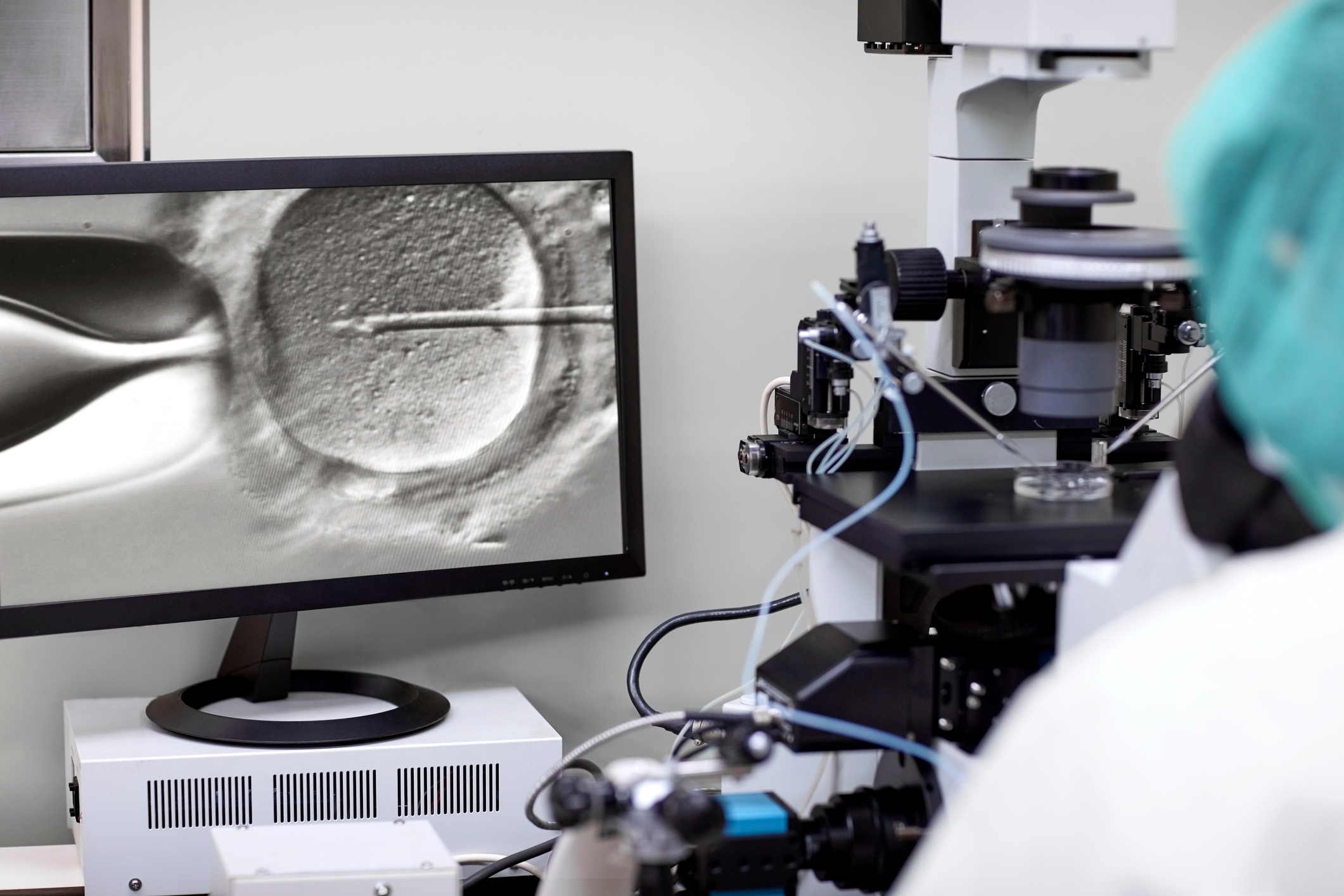 embryologist in embryology lab looking at microscope on screen doing egg fertilisation IVF fertinitly Thomson Fertility Centre