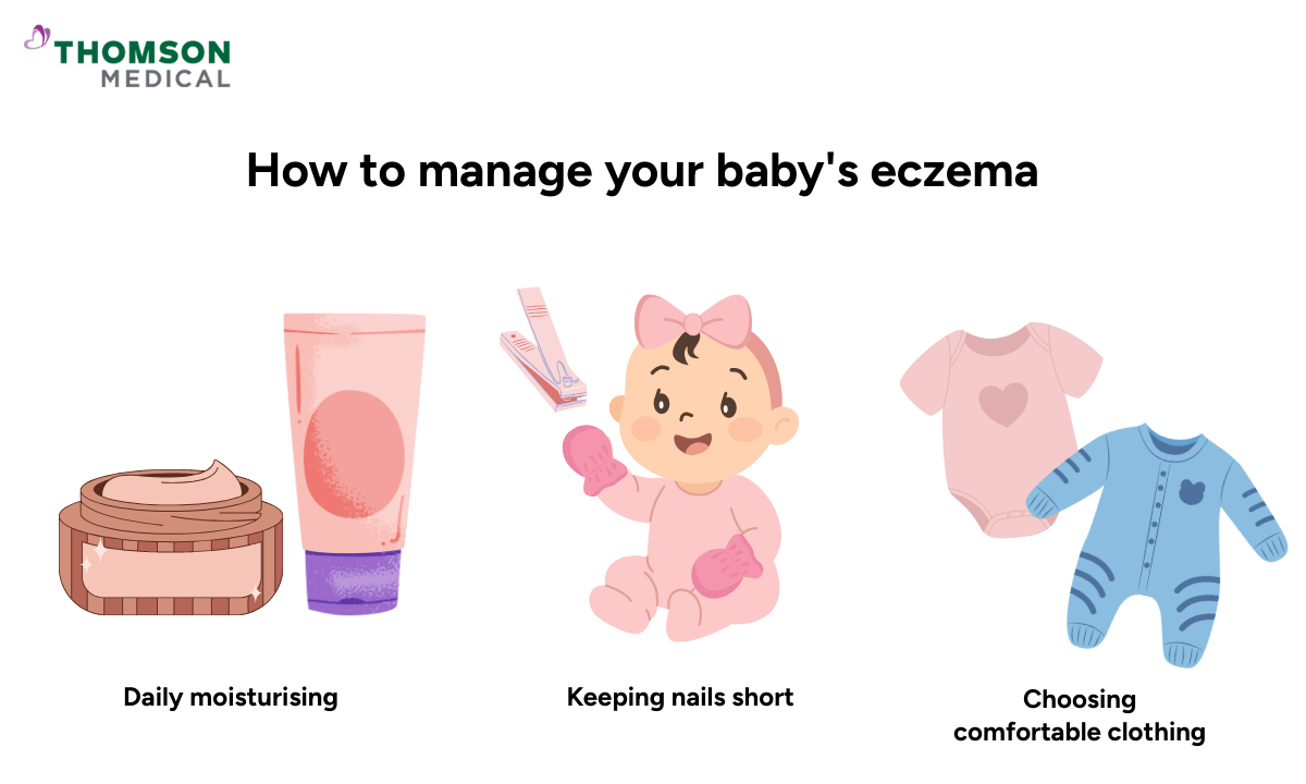 Illustration showing how to manage your baby's eczema