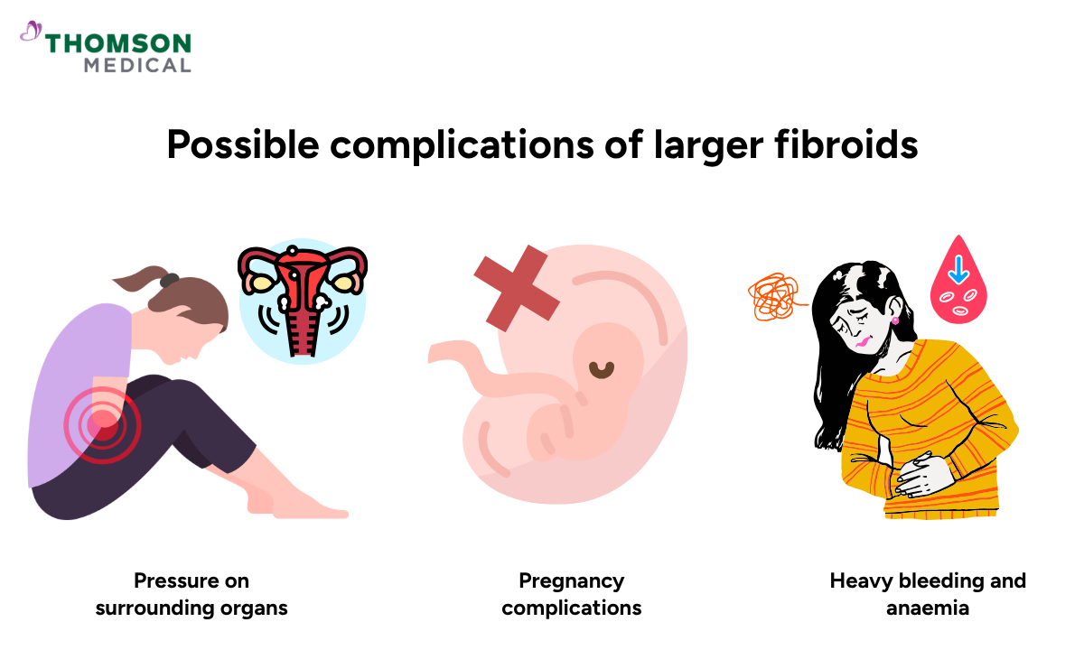 Illustration on the possible complications of larger fibroids