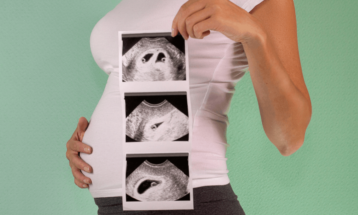 Ultrasound image of twin pregnancy