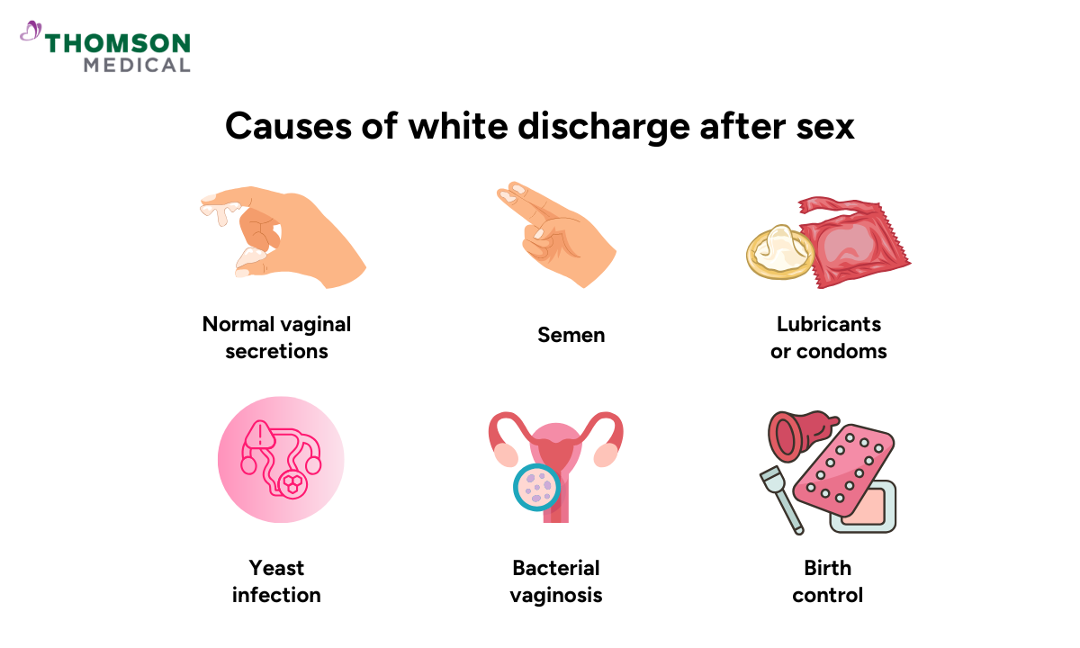 blog-image_obgyn_causes-of-white-discharge-after-sex.png