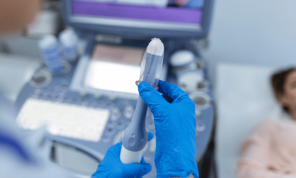A medical professional wearing blue gloves preparing a transvaginal ultrasound probe with a protective cover in front of an ultrasound machine.