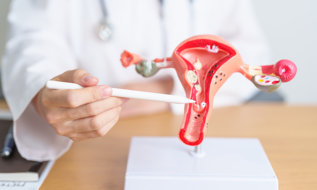 Illustration of an uterus