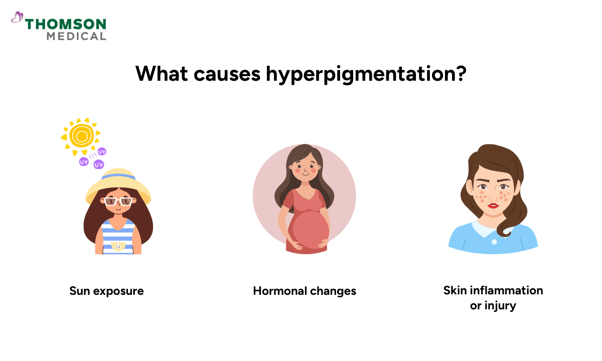 blog-image_dermatology_what-causes-hyperpigmentation.png