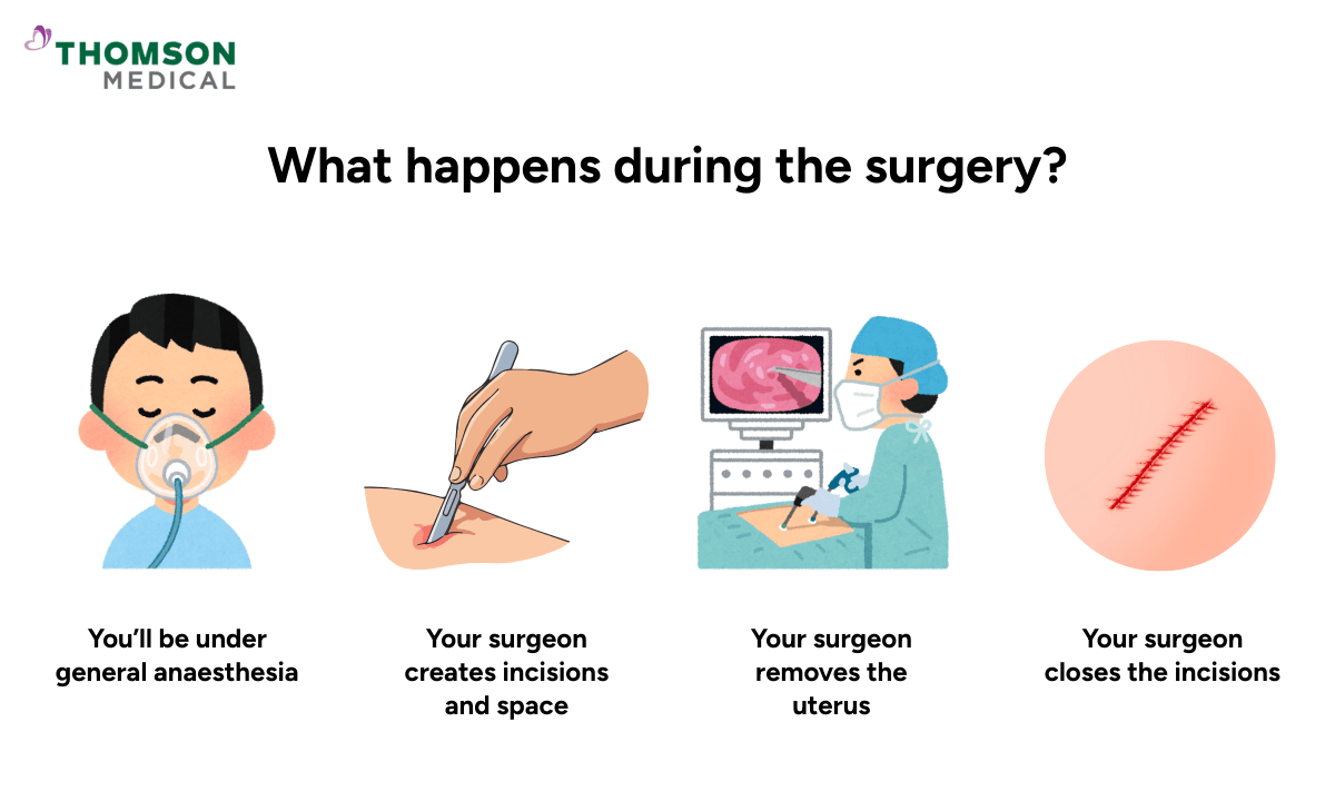 laparoscopic-hysterectomy-procedure