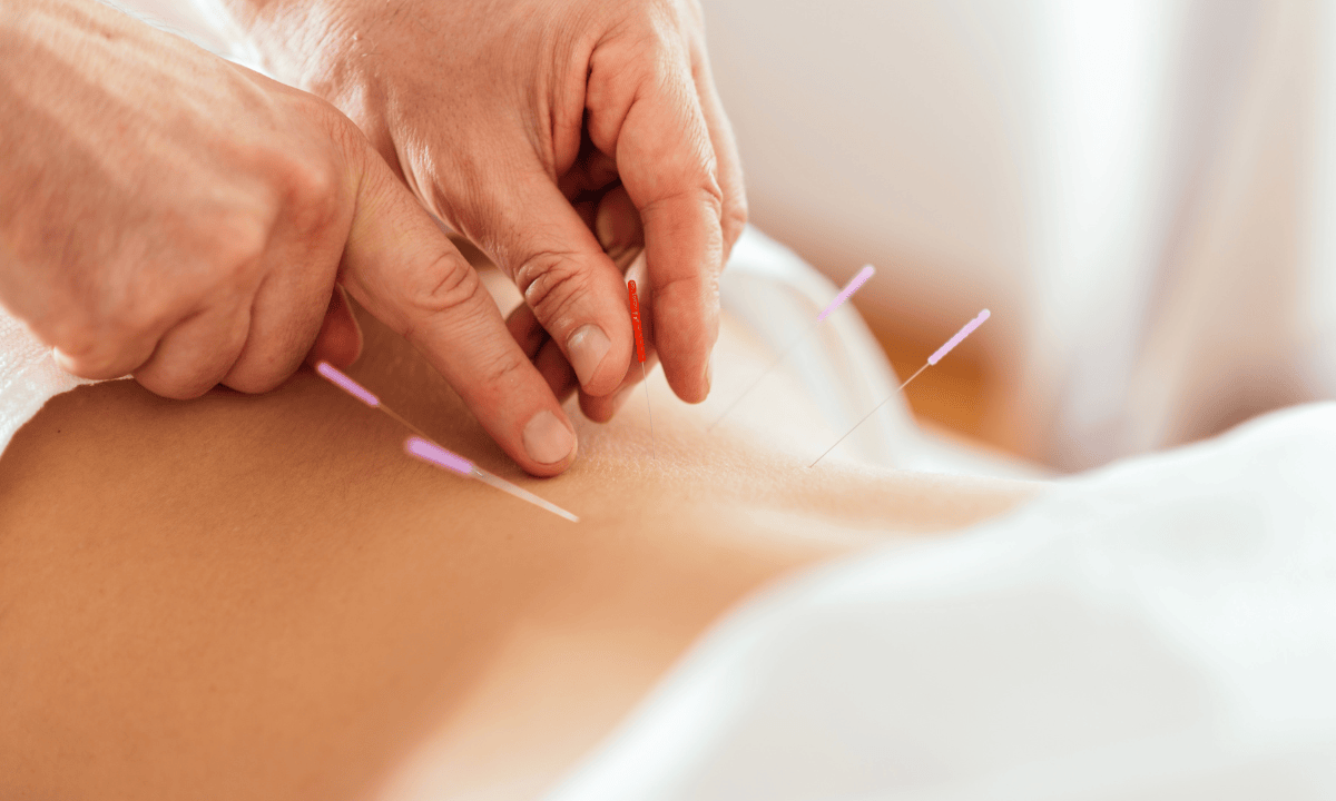 a-woman-is-enjoying-acupuncture-session