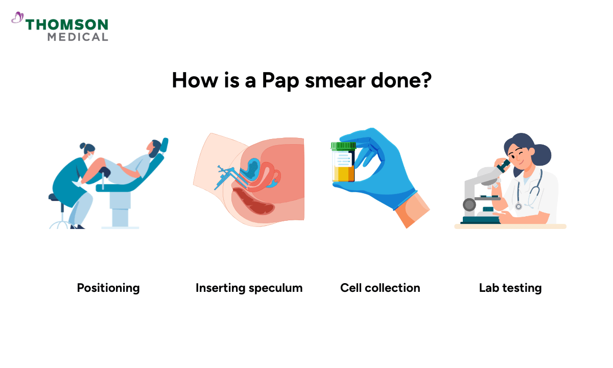 how is a pap smear done