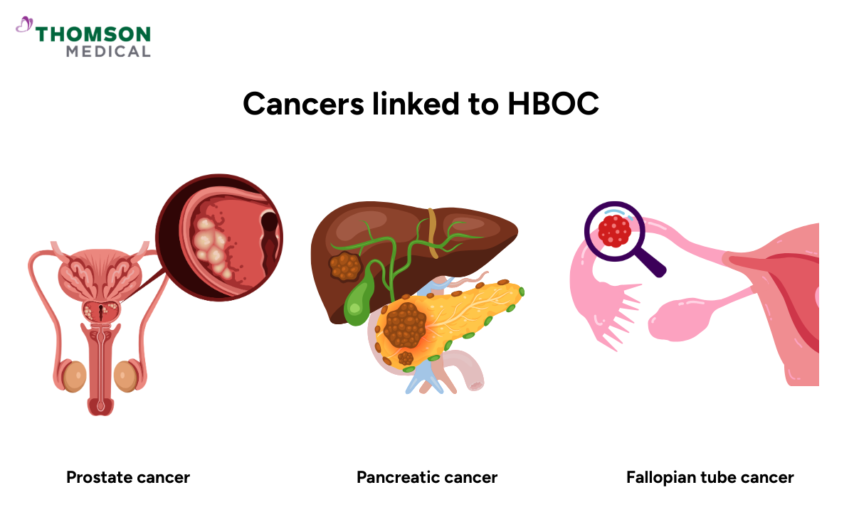 Illustration shows cancer linked to HBOC