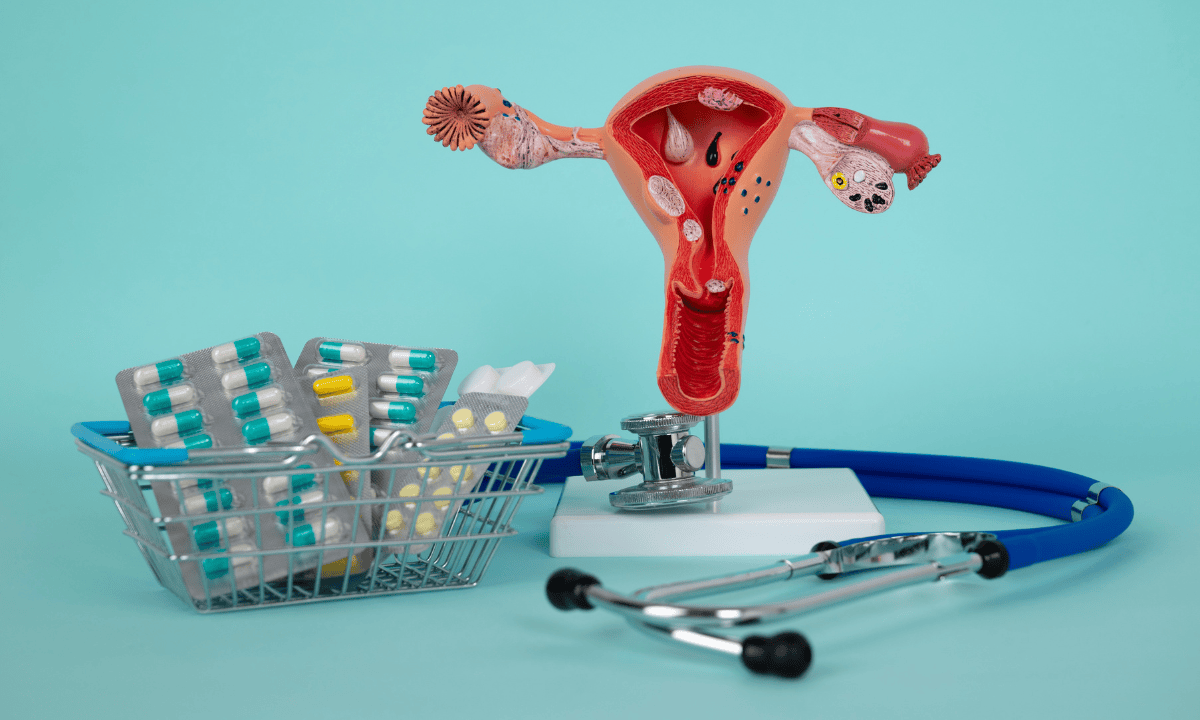 image of treatment for polyp and fibroid