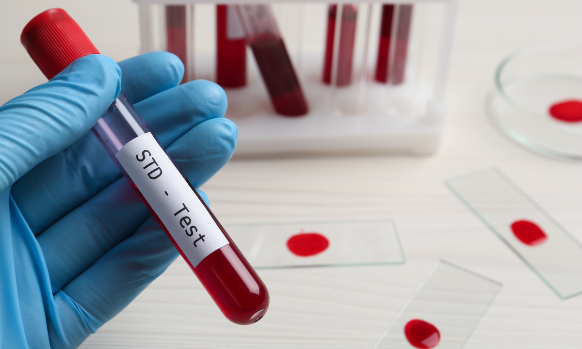 image of blood vial for STD test