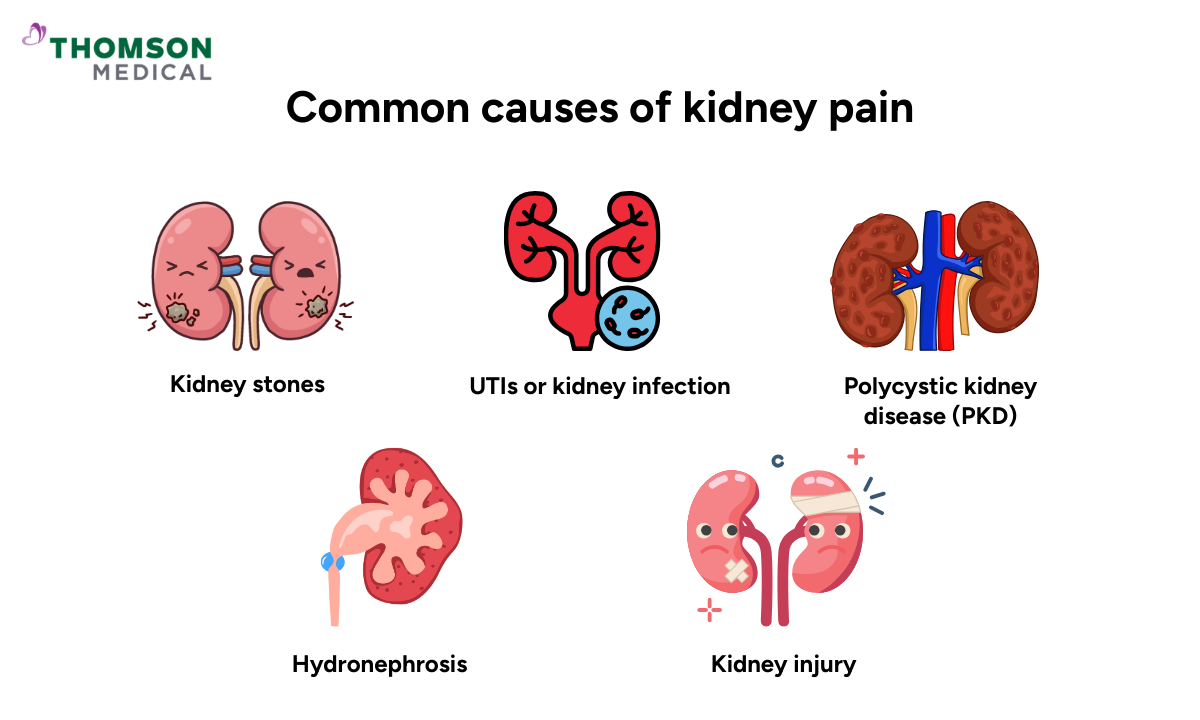 Common causes of kidney pain
