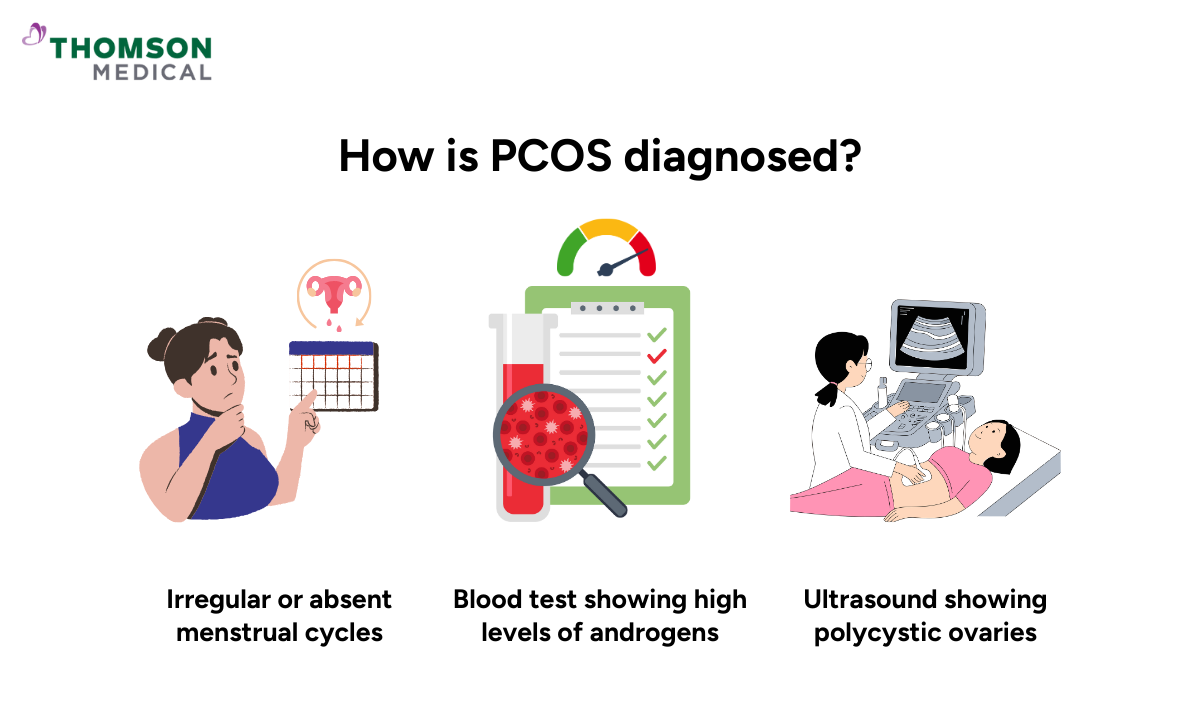 illustration how pcos is diagnosed