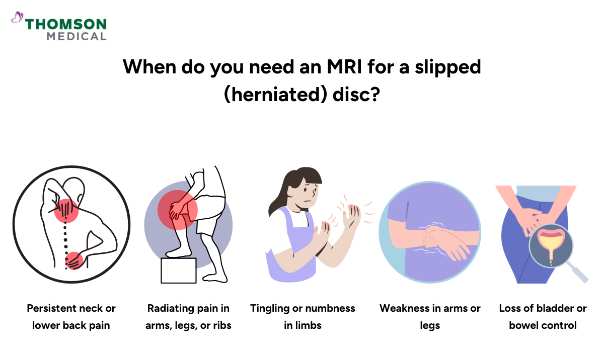 blog-image_screening_when-you-need-herniated-disc-mri.png