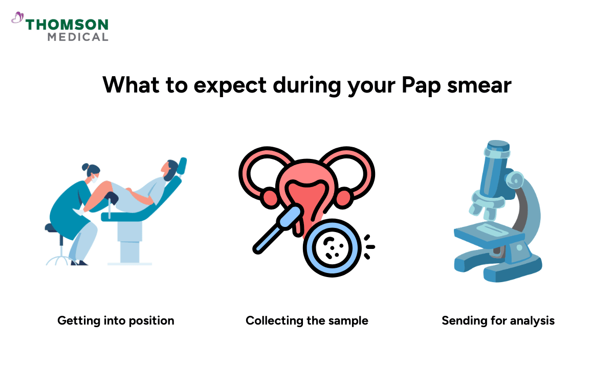pap-smear-procedure