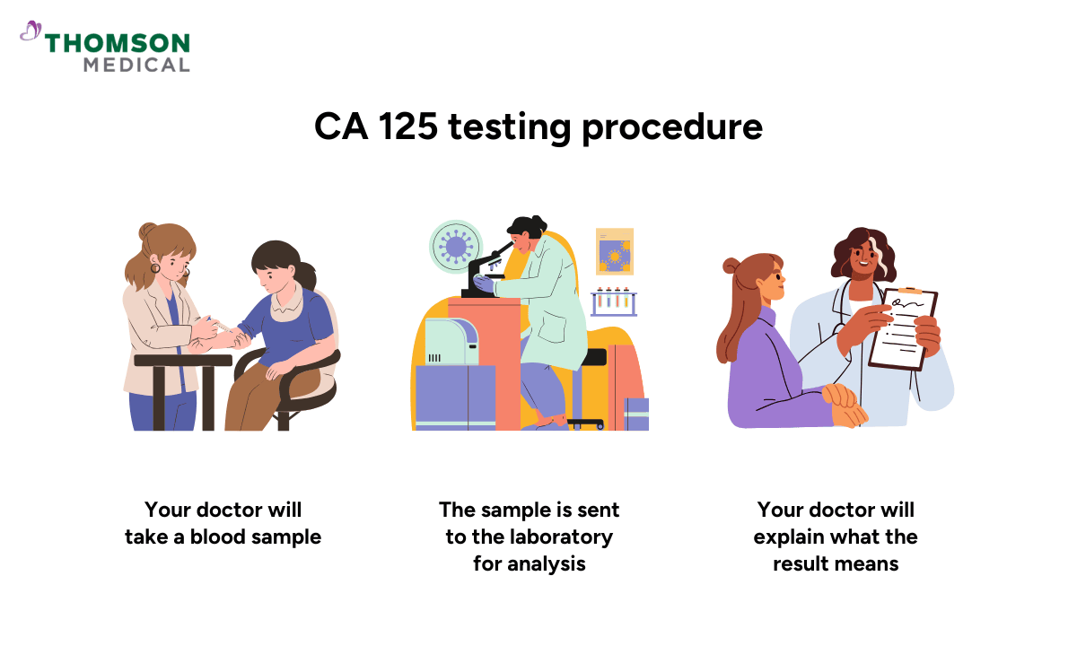 blog-image_obgyn_ca-125-testing-procedure.png