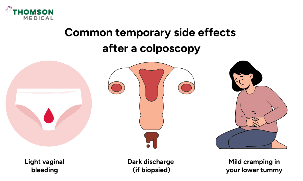 A graphic on common temporary side effects after a colposcopy, illustrating light vaginal bleeding, dark discharge (if biopsied), and mild cramping in the lower tummy.