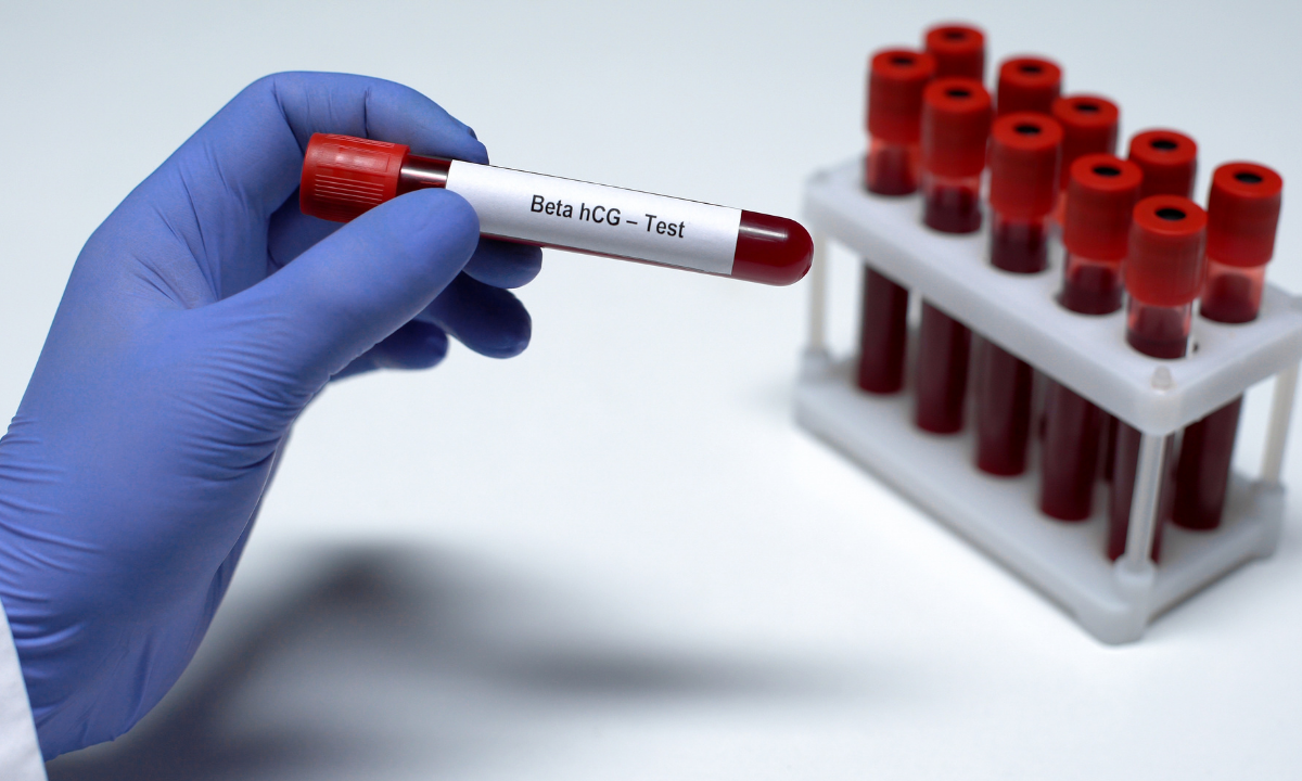 image of blood vial for beta hcg test